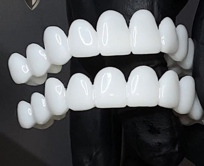 Adjustable Dental Veneer — Instant White Smile Correction 5