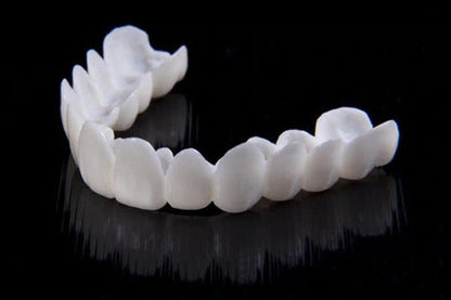 Adjustable Dental Veneer — Instant White Smile Correction 6