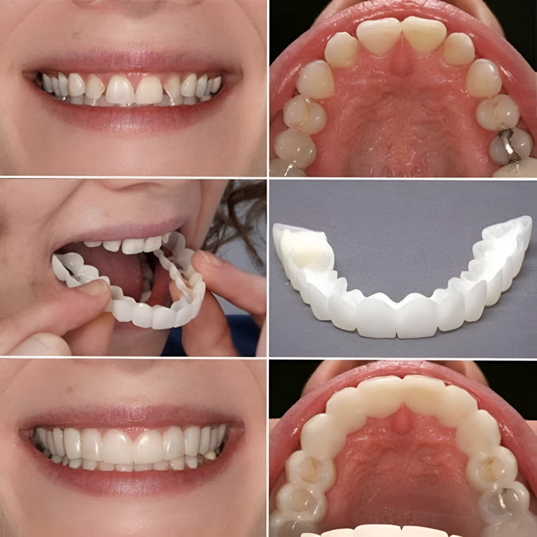 Clip-On Teeth Veneers — Snap Fit Cosmetic Smile Cover 5