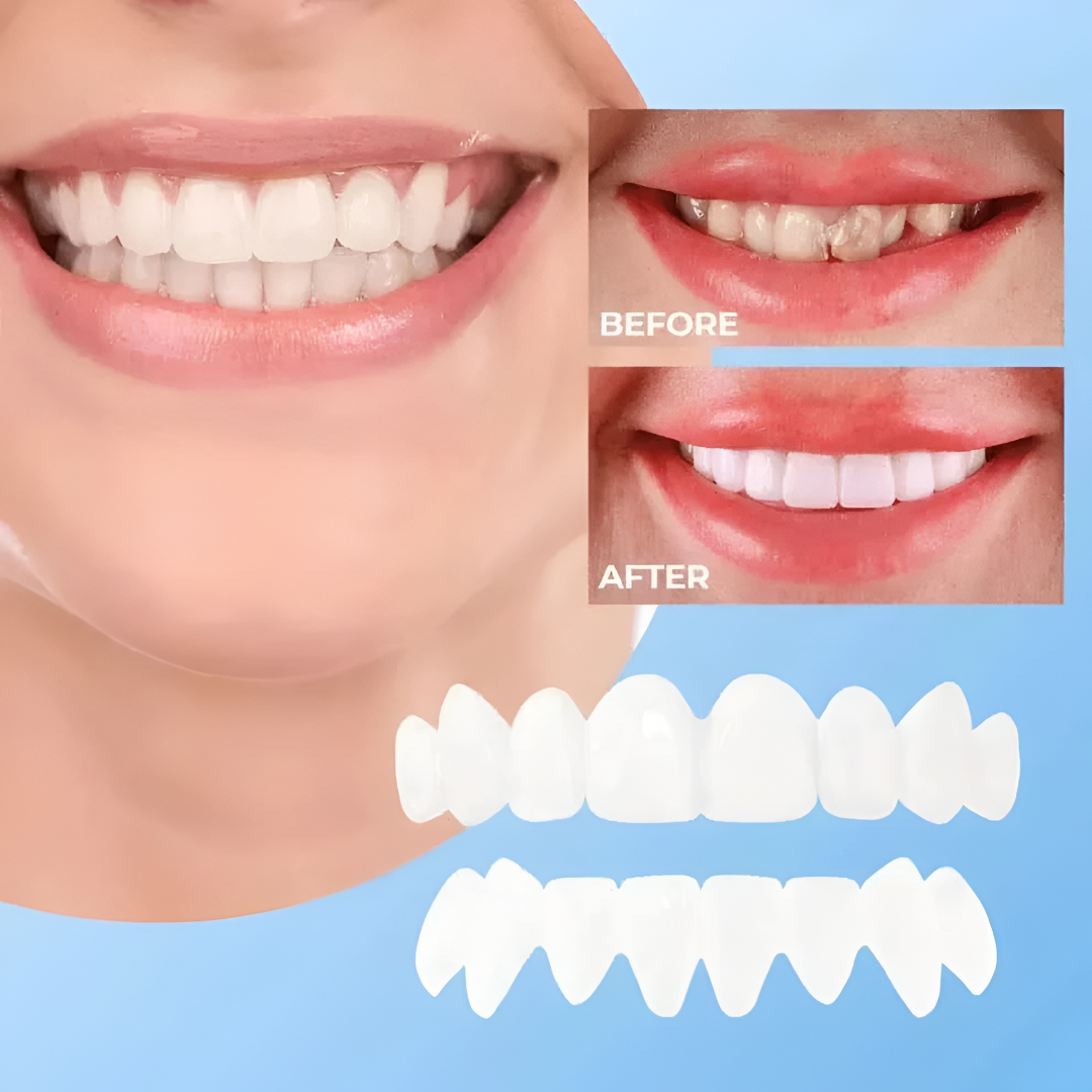 Clip-On Teeth Veneers — Snap Fit Cosmetic Smile Cover 6