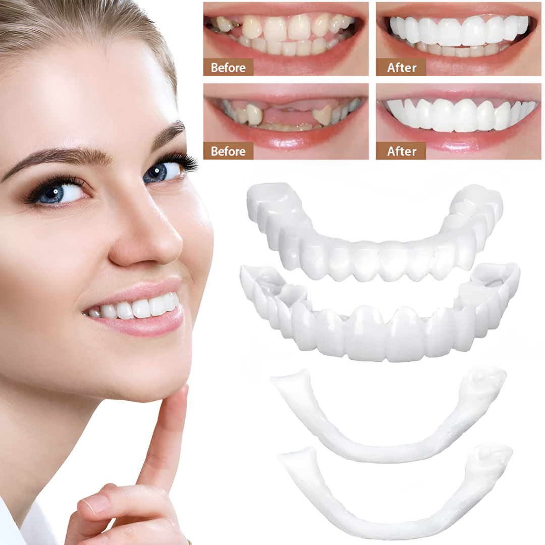 Clip-On Teeth Veneers — Snap Fit Cosmetic Smile Cover 7