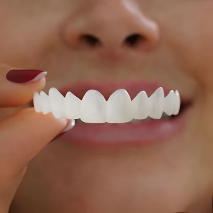 Clip-On Teeth Veneers — Snap Fit Cosmetic Smile Cover 1