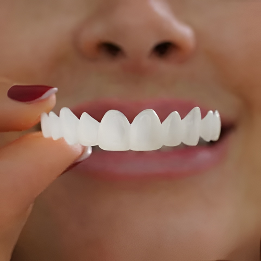 Clip-On Teeth Veneers — Snap Fit Cosmetic Smile Cover 1