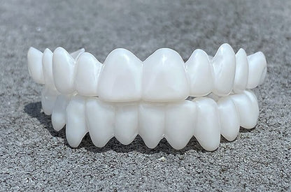 Dental Prosthesis — Customizable Veneers for a Natural Smile 3