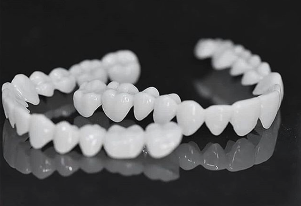 Dental Prosthesis — Customizable Veneers for a Natural Smile 5