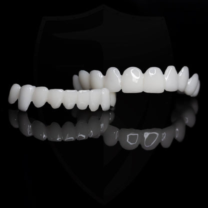 Dental Prosthesis — Customizable Veneers for a Natural Smile 6