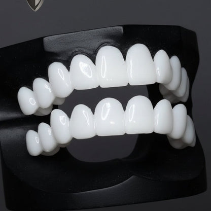 SmileFlex Dental Prosthesis — White Veneers, Adjustable Fit 5