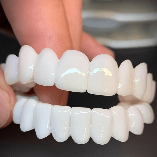 SmileFlex Dental Prosthesis — White Veneers, Adjustable Fit 1